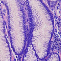 May Grunwald Giemsa for tissue sections