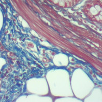 Masson Trichrome