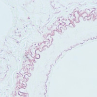 Orcein